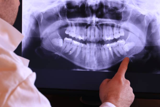Best Emergency Dental Care for Broken or Chipped Teeth in Richmond, IL